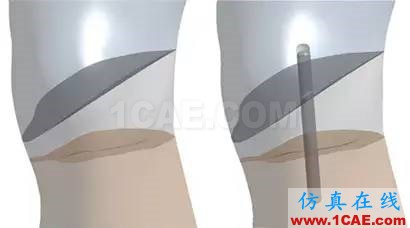 亚当沉浮录--大都会艺术博物馆的保管员邀请仿真专家帮助修复具有600年历史的雕塑 美国仿真专家首次利用ANSYS协助修复破损的雕塑ansys培训课程图片6
