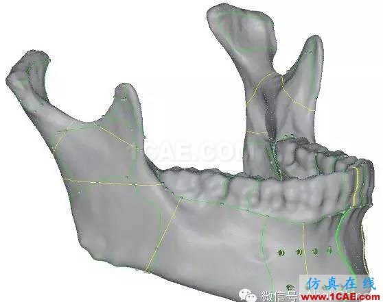 Hypermesh 2015 CAE 有限元网格竞赛作品案例hypermesh分析图片10