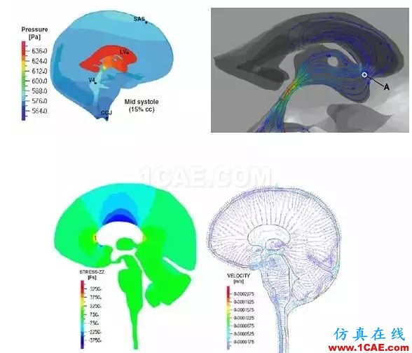 人体组织三维建模技术与有限元仿真前沿制造技术图片3