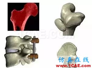 人体组织三维建模技术与有限元仿真manufacturing图片7